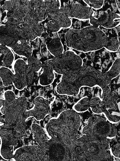 Photogram by the artist Sunah Choi. Camouflage and other patterns superimposed in black, white and shades of gray.