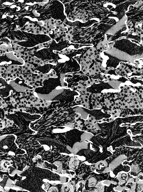 Photogram by the artist Sunah Choi. Multiple patterns superimposed in black, white and shades of gray.